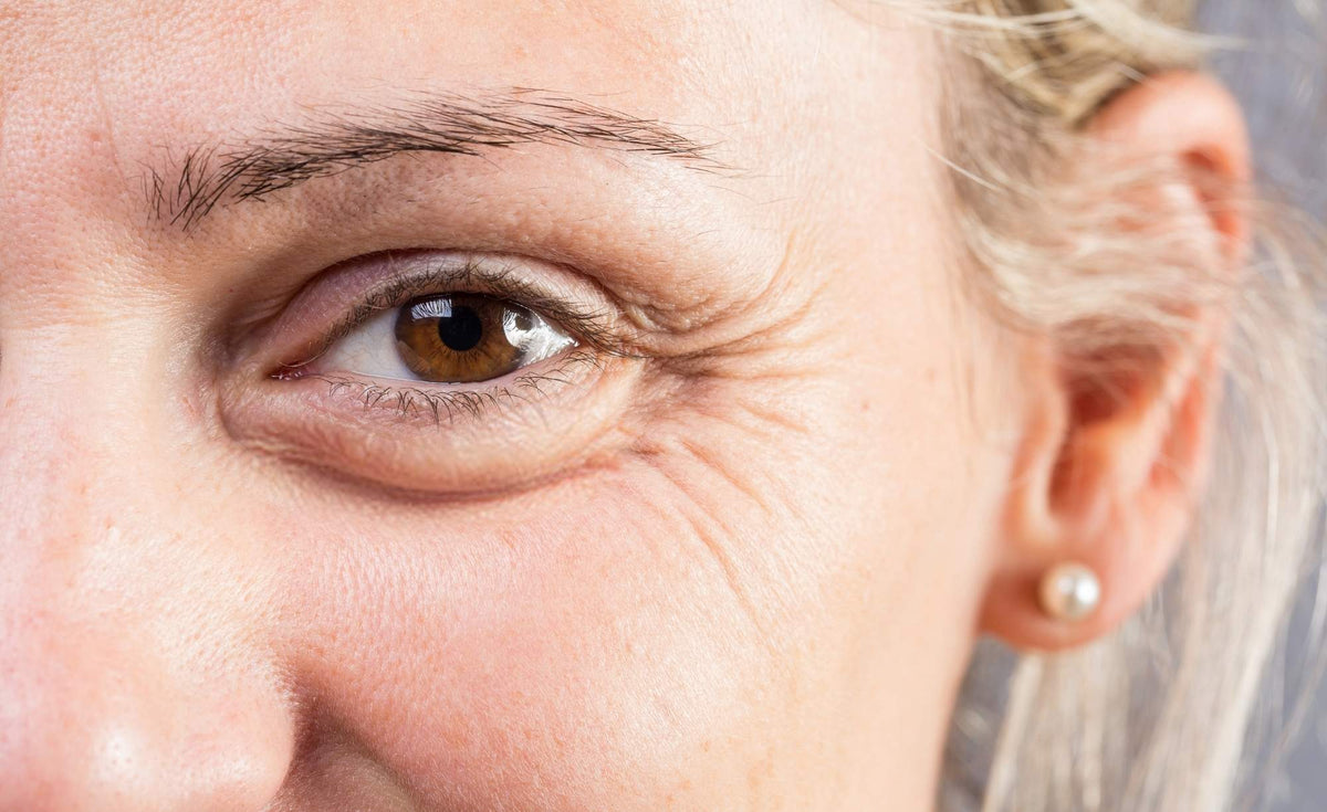 What your wrinkles are telling you