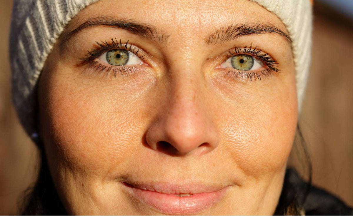 The secret causes of dark circles