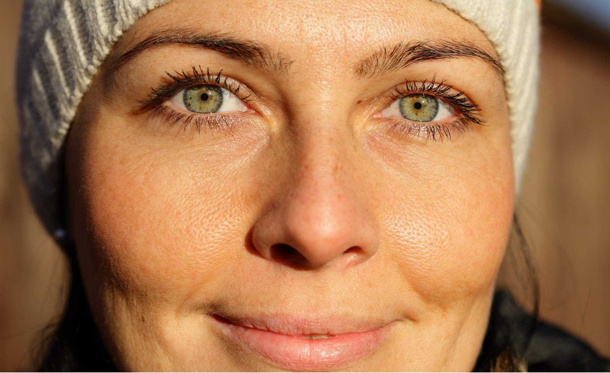 Dark Circles Under Eyes | Causes, Solutions & Expert Advice