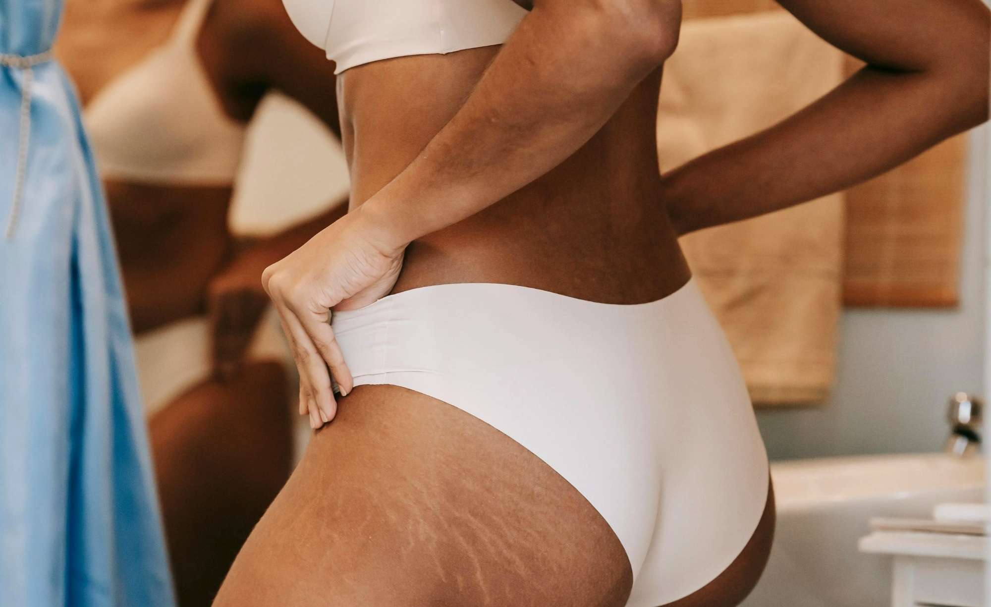Stretch Marks: A Skin Expert's Honest Guide to Treating Them
