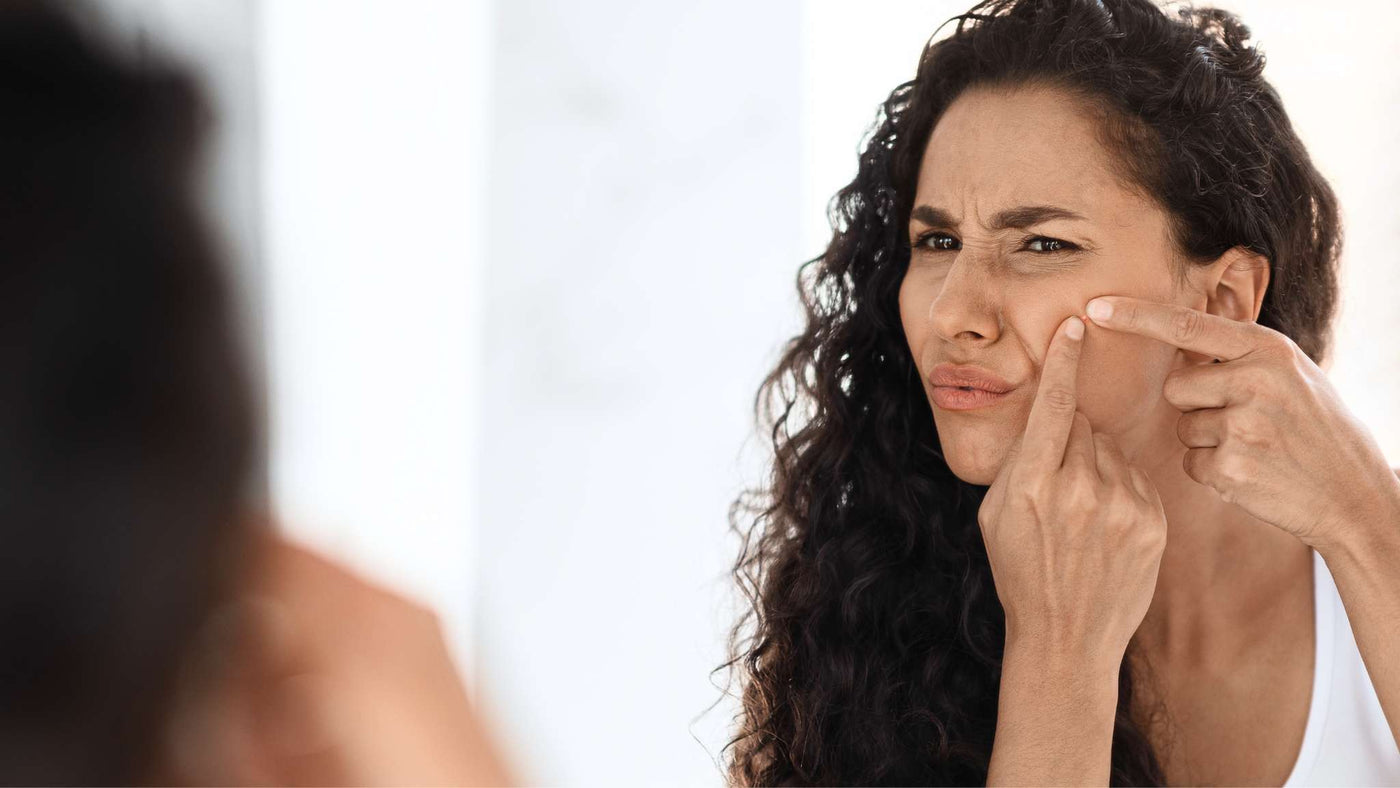 Why you're still getting hormonal spots & how to quickly treat them 