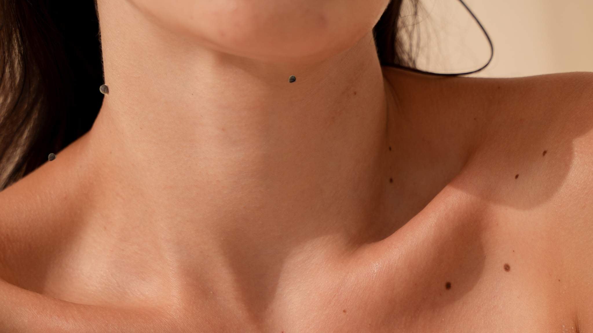 Say Goodbye to Skin Tags: Causes, Prevention & Treatment