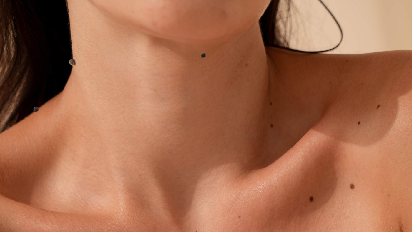 Say Goodbye to Skin Tags: Causes, Prevention & Treatment