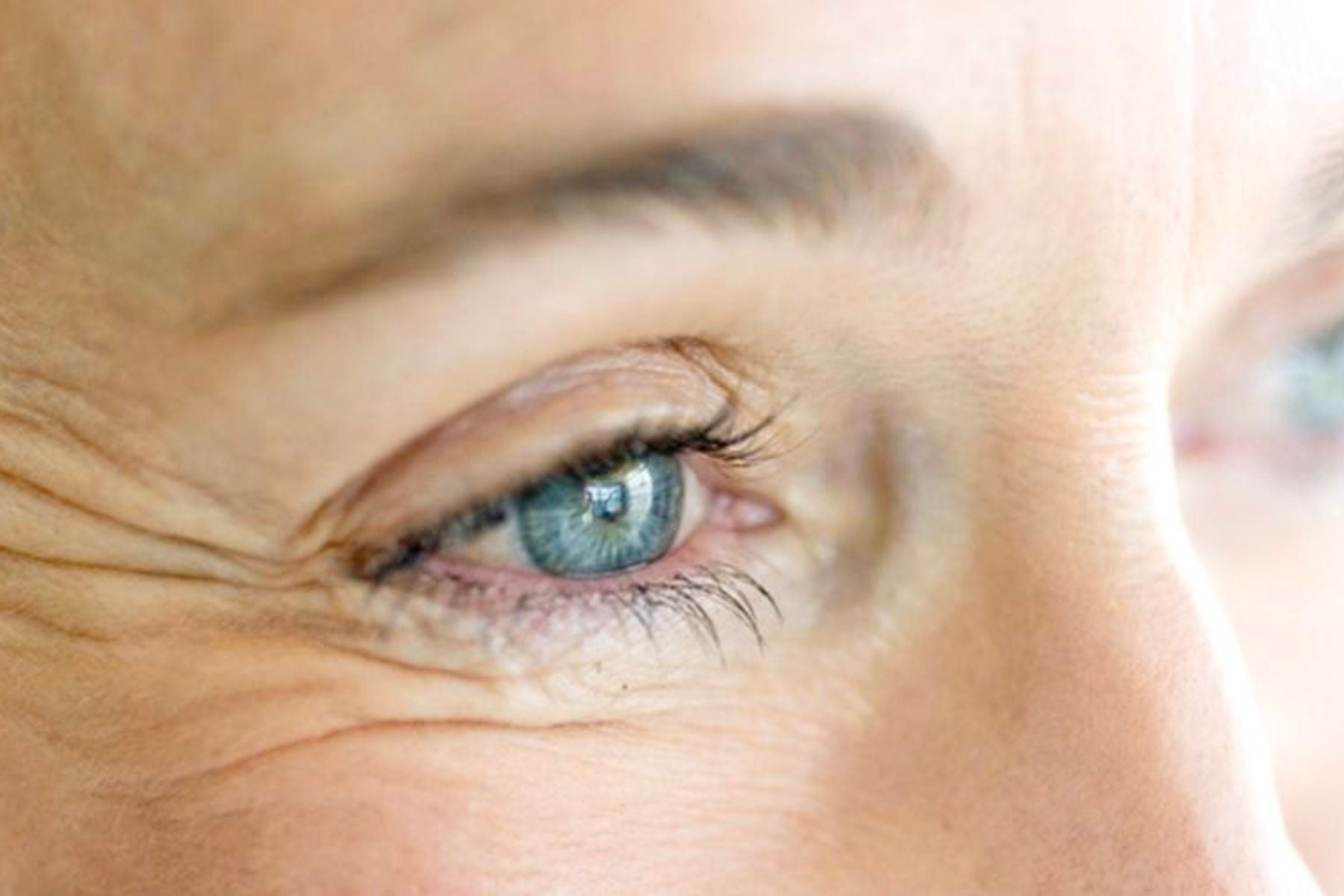 Why are my eyes ageing so quickly? Answered by skin expert Amy Frith at BASE SKNCARE