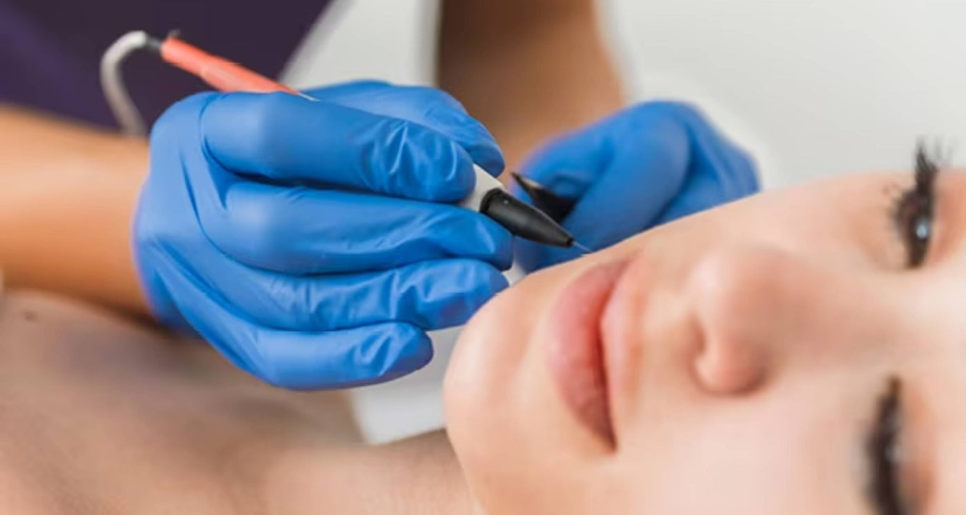 What are thread veins (spider veins) and how to quickly treat them