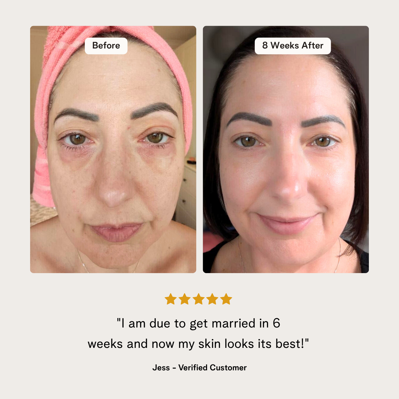 The 5 Minute Kit by BASE SKNCARE - The only skincare routine you will ever need. 